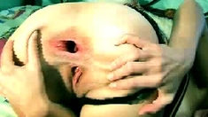 Bestanalxx Russiandoll Massive Gape