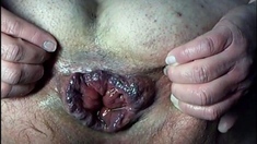 Assorted Amateur Anal Gape Fun